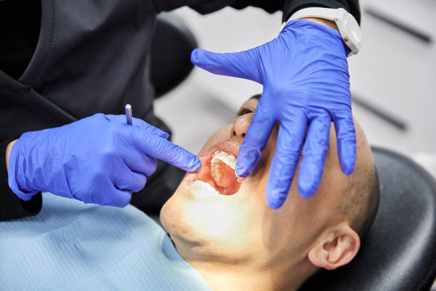 Best Pediatric Emergency Dentist in Brewerton, NY